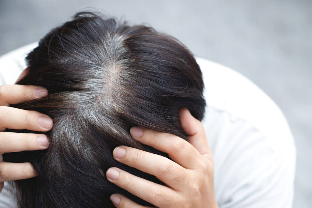 Back view of young people premature gray hair