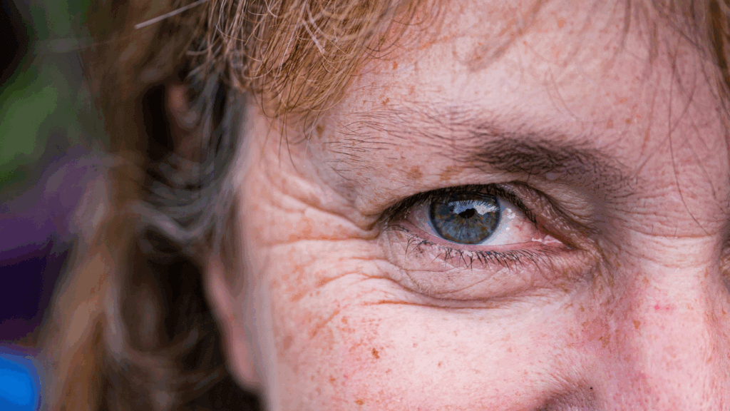 Close-up of a freckled person’s face and eyelashes in natural light