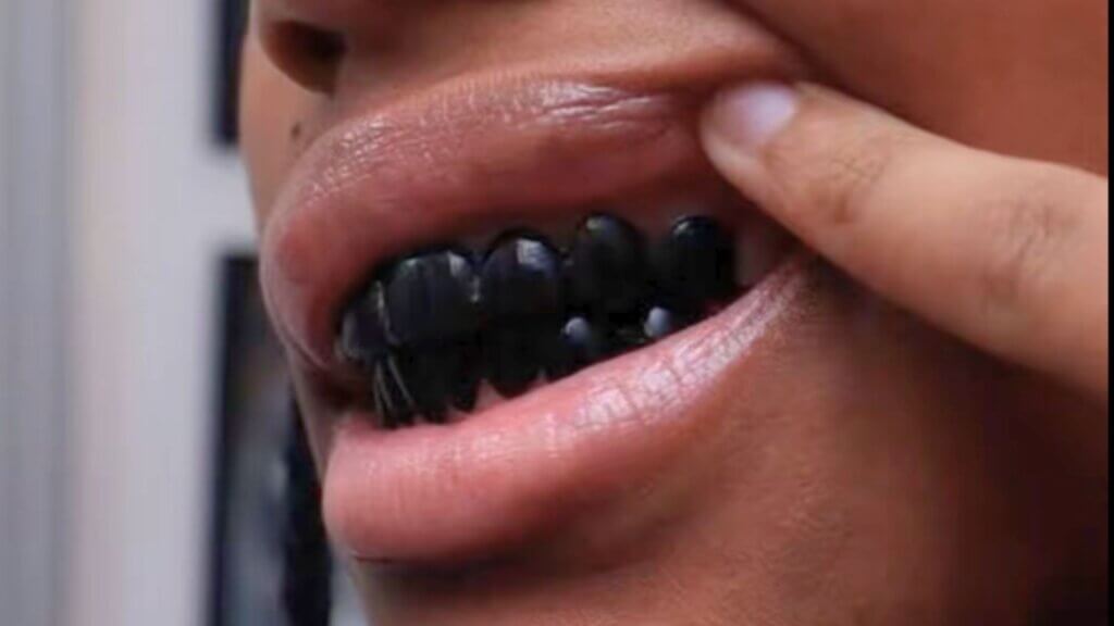 How Blackened Teeth Became a Viral TikTok Look