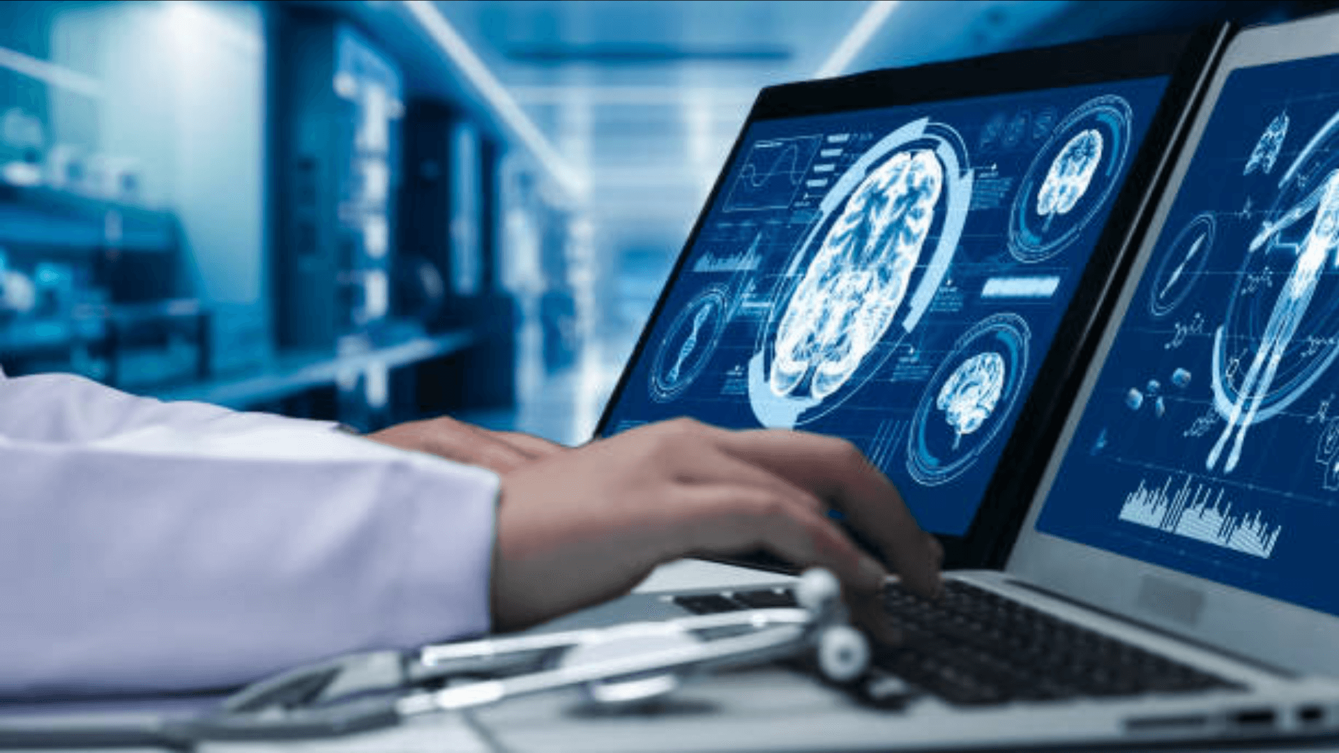 A brain scan image on a computer screen
