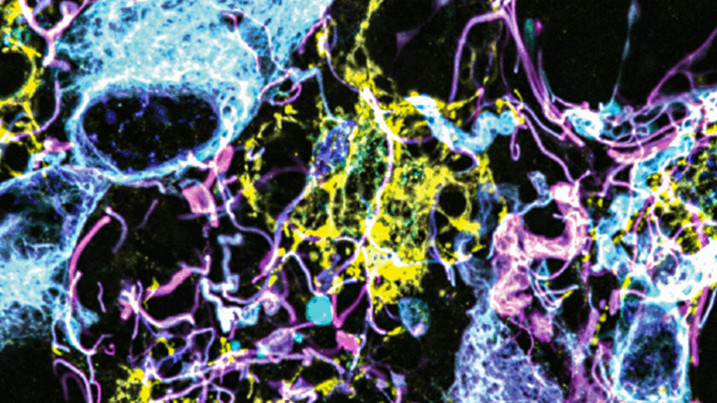 Colorful close-up of brain cells under a microscope.