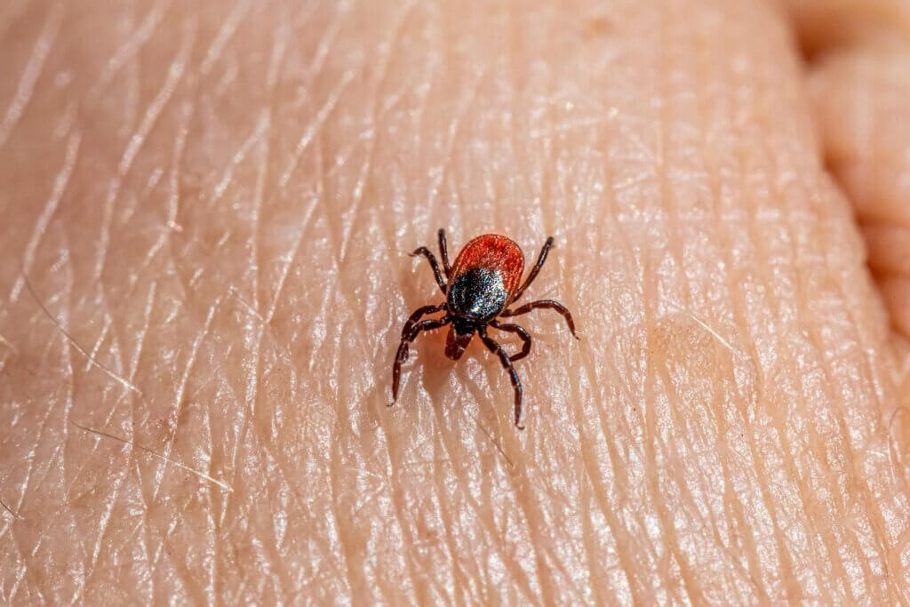 Close-up of a tick crawling on human skin.