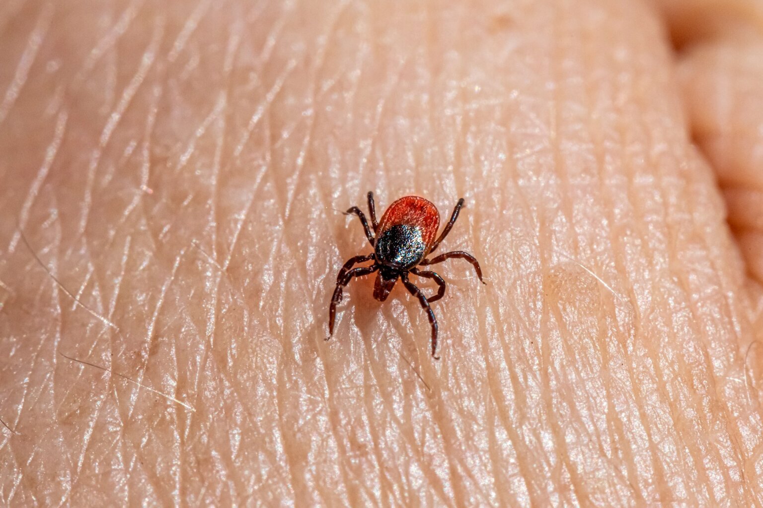 Close-up of a tick crawling on human skin.