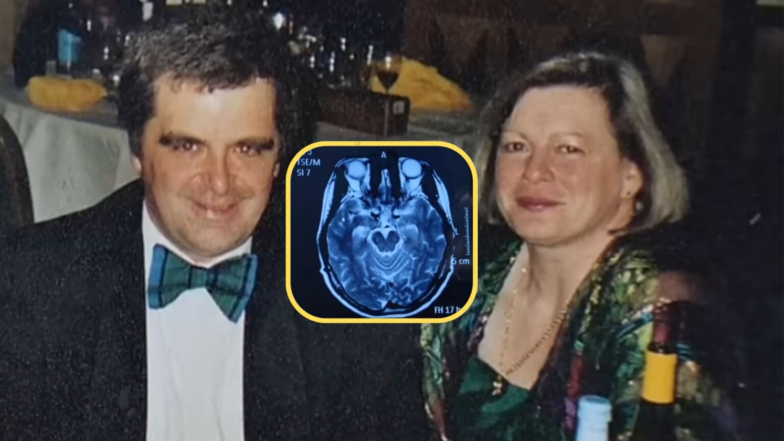 Man in a tuxedo and woman seated together at a formal event, with a brain scan image overlaid between them.