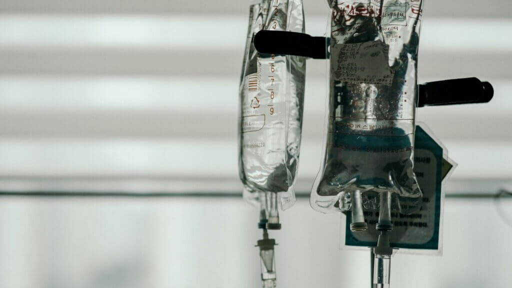 IV fluid bags hanging on a stand with tubes connected for patient treatment.