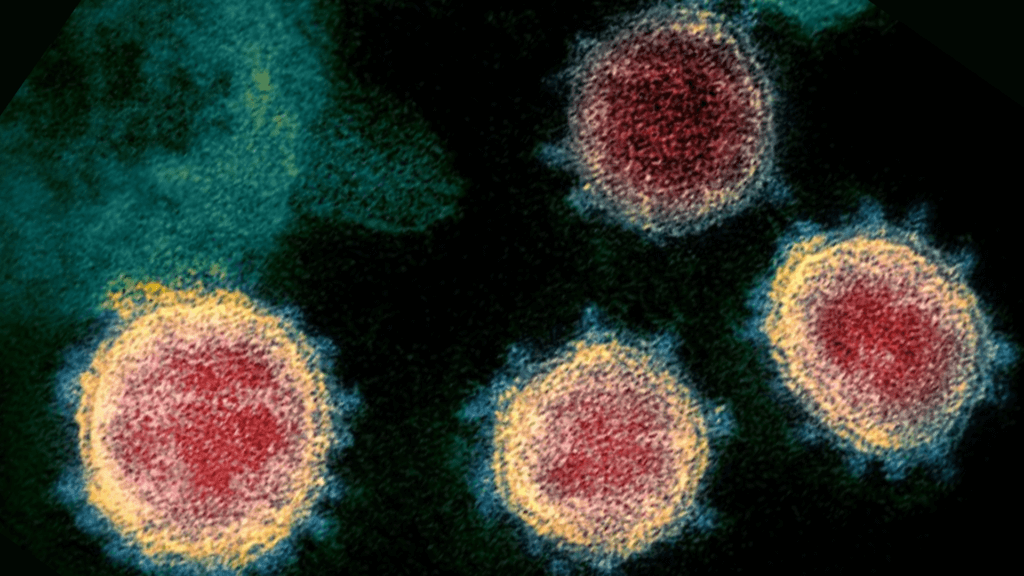 A high-magnification microscopic view showing several spherical COVID-19 virus particles with their characteristic spiked outer crowns against a dark background.
