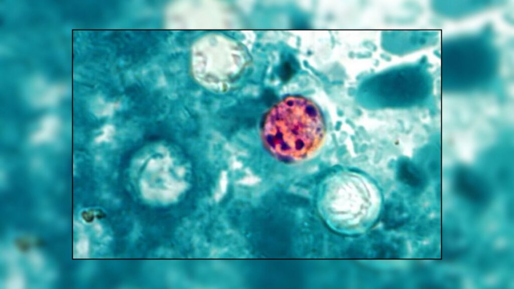 Microscopic image of the Cyclospora cayetanensis parasite.