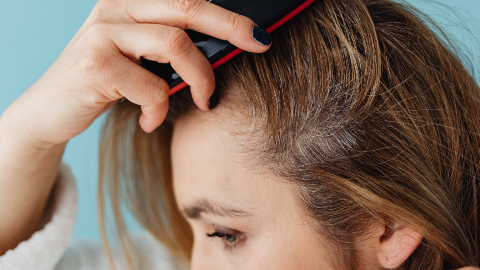 Why Does Hair Loss Seem So Common in Women Right Now?