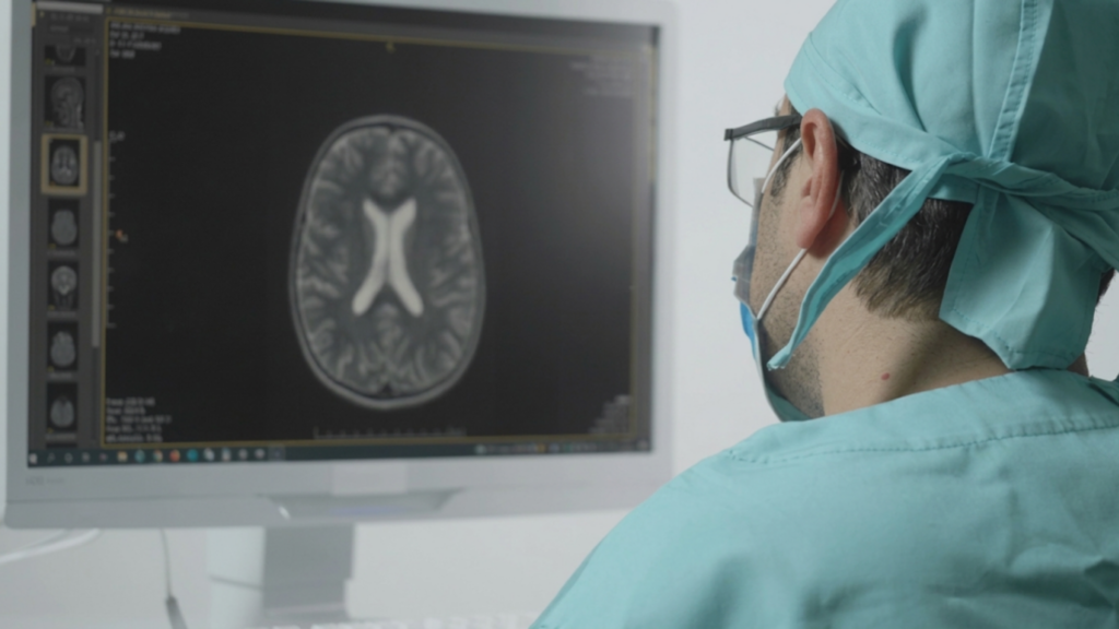 A medical professional reviews a brain MRI on a computer screen, assessing the scan for diagnostic purposes.