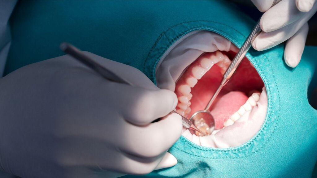 A dentist uses a dental mirror and probe to examine a patient's open mouth under a surgical drape.