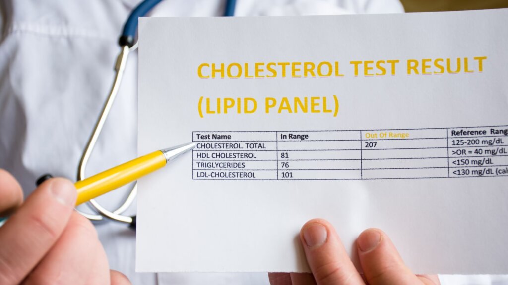 Doctor holds a cholesterol test result showing total cholesterol 207, HDL 81, triglycerides 76, and LDL 101, with a yellow pen.