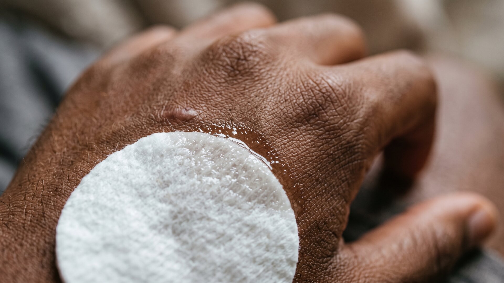 Macro detail of a cotton pad and liquid on skin texture, illustrating the surface layer that exfoliating acids thin.